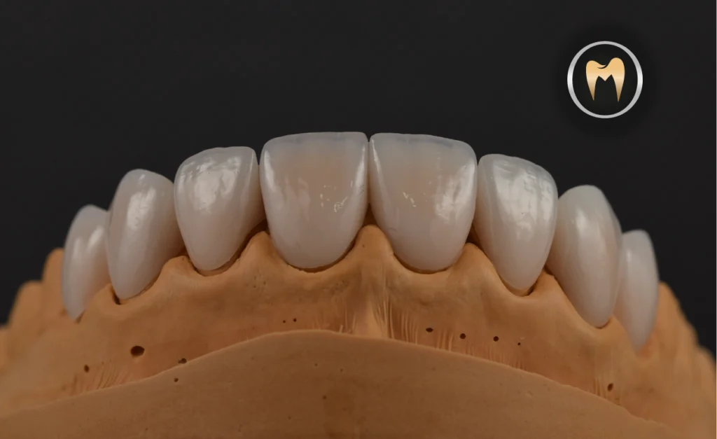 IMAGEN PROYECTO PACIENTE ORAL MASTER ODONTOLOGÍA ESTÉTICA Y LABORATORIO DENTAL