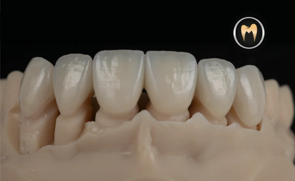 IMAGEN PROYECTO PACIENTE ORAL MASTER ODONTOLOGÍA ESTÉTICA Y LABORATORIO DENTAL